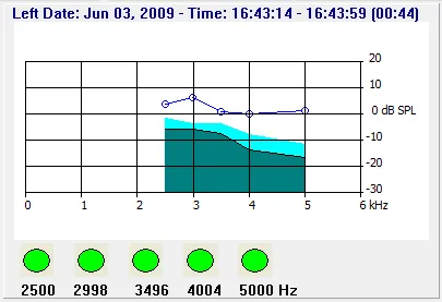 HW180.OP06_Screening_Ergebnis_DPOAE.webp