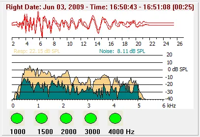 HW180.OP06_Screening_Ergebnis_TEOAE.webp