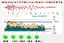 HW180.OP06_Screening_Ergebnis_TEOAE.webp
