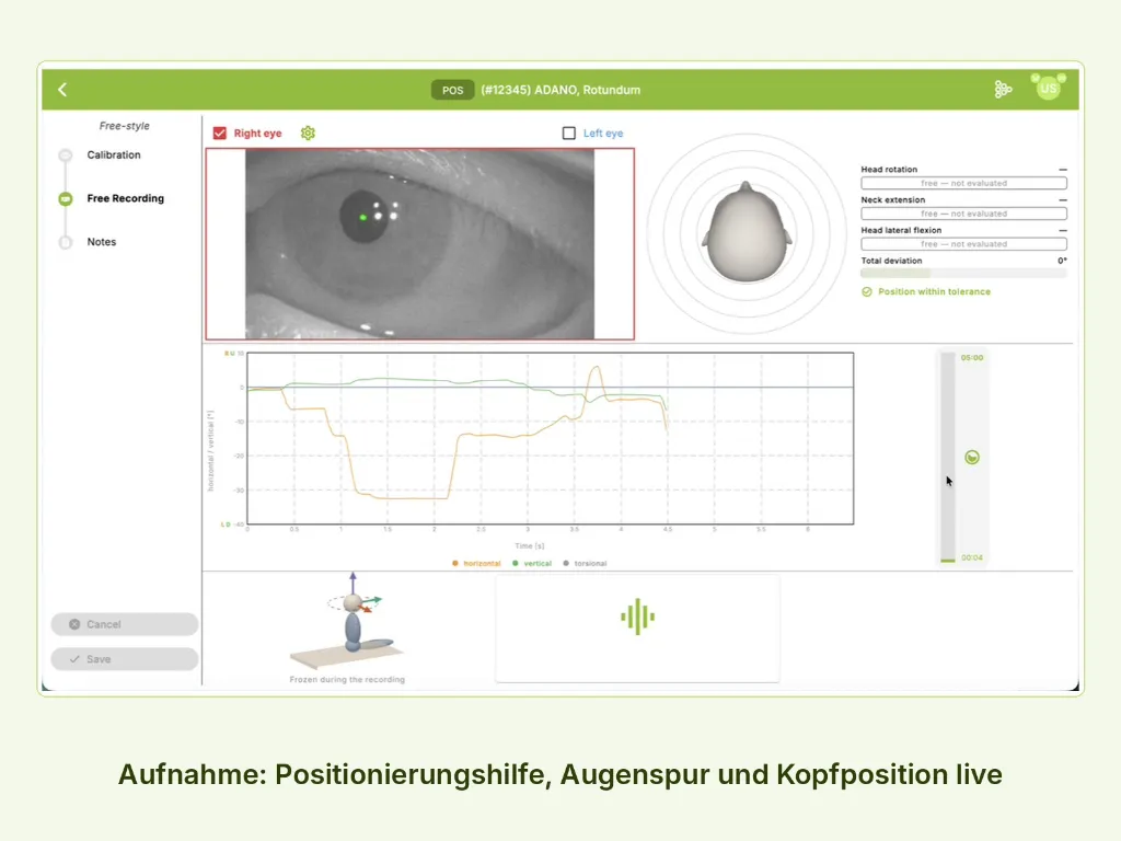 POS_1_Aufnahme_Positionierungshilfe.webp