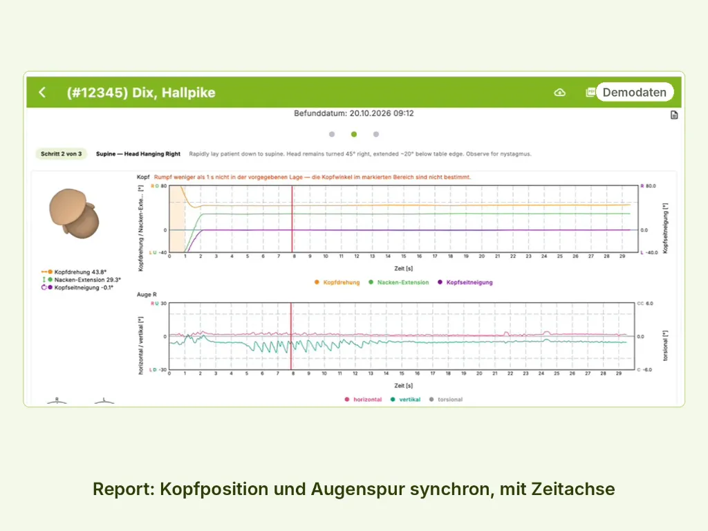 POS_2_Report_Kopfposition_Augenspur.webp