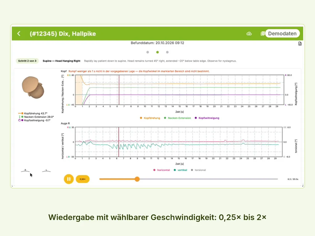 POS_3_Wiedergabe_Zeitlupe.webp