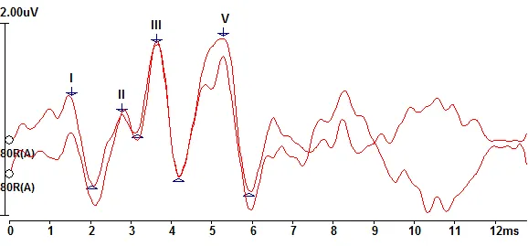 [HW180.OP03] SmartEP Software
