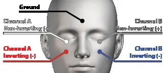 SmartVEMP (Standalone)