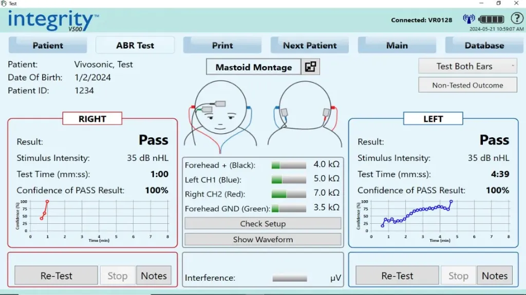 Automated ABR Screening Software License and Hardware Kit
