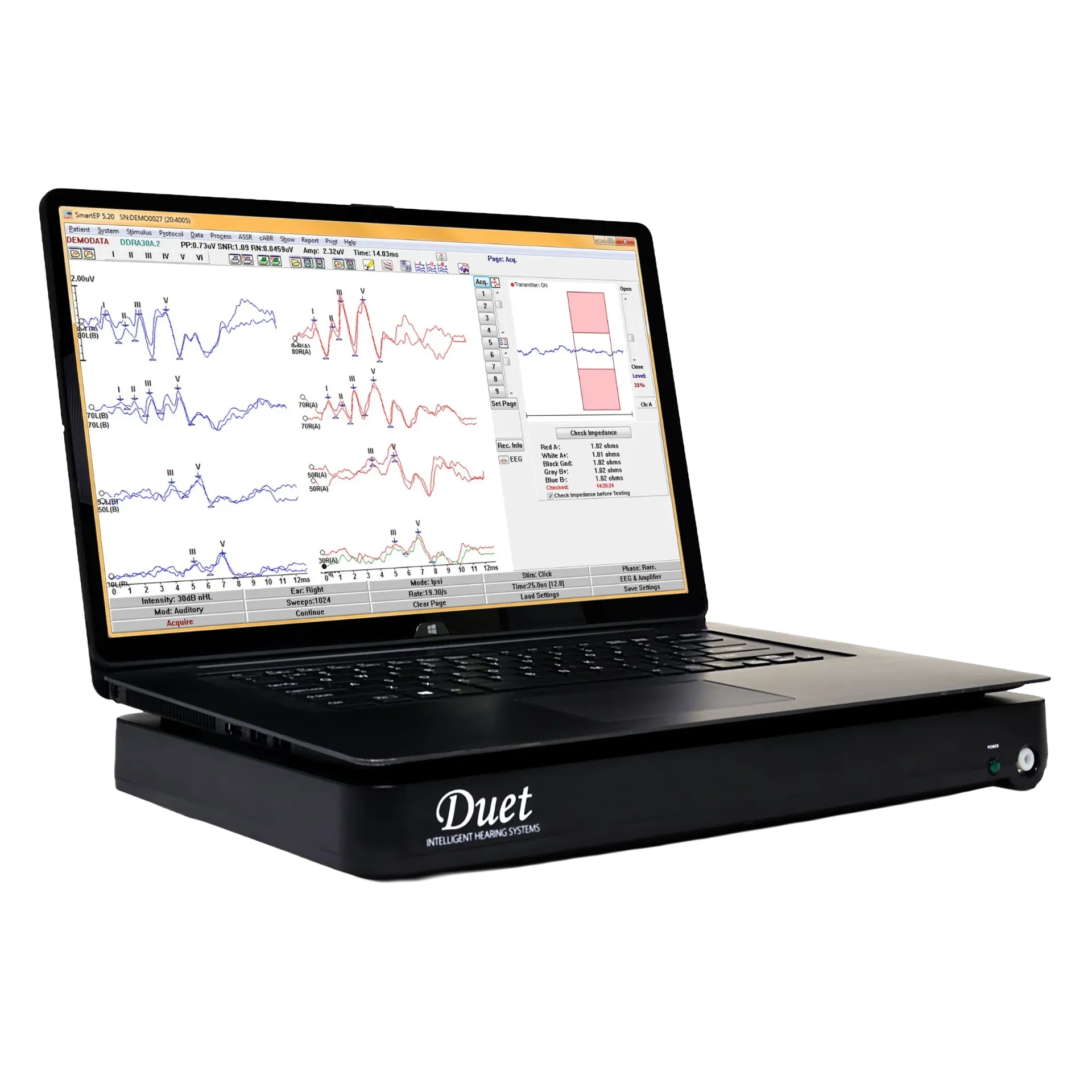 [HW180.AR01] Basismodul Duet 2-Kanal AEP-System